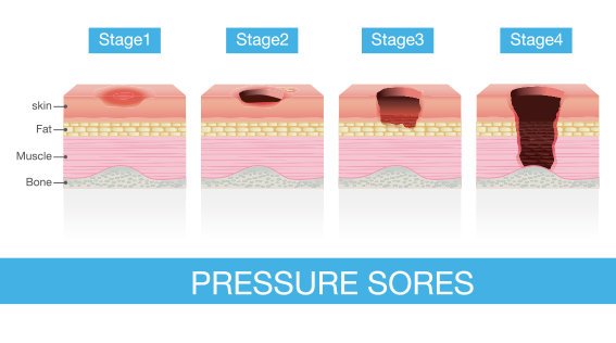 2025-2026 Patient Safety Award and Grant Program Topic: Skin and Pressure Injury Reduction